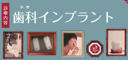 歯科インプラント
